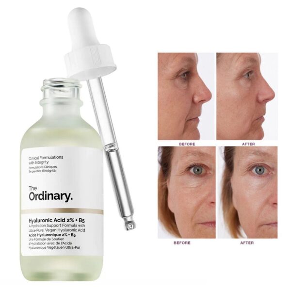 The Ordinary Hyaluronic Acid 2 B5 Hydration Support Formula 30ml 60ml