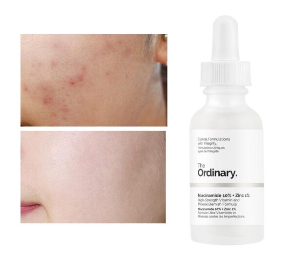 The Ordinary Niacinamide 10 zinc 1 Serum 10