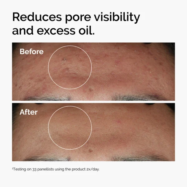 سرم نیاسینامید اوردینری The Ordinary Niacinamide 10% + Zinc 1% - Image 3