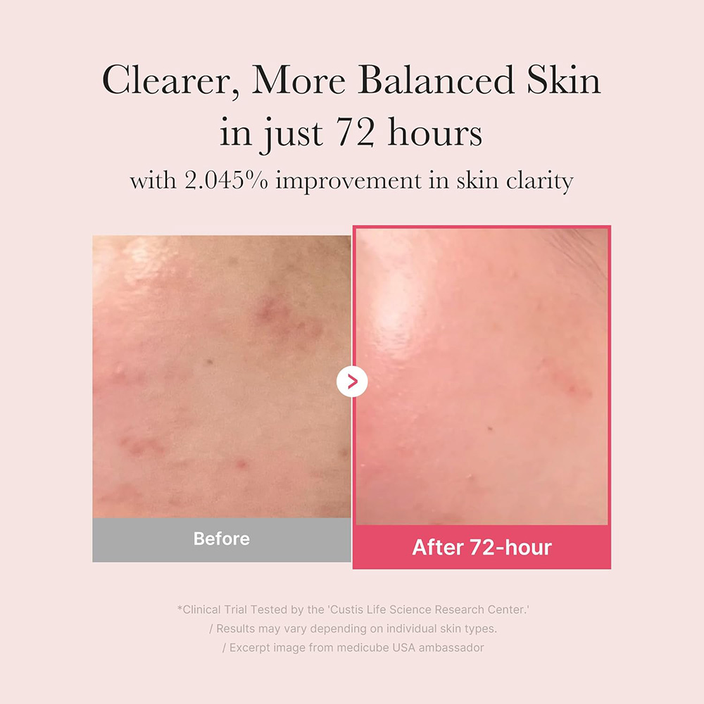 سرم ضد لک مدیکیوب TXA Niacinamide 15% 4 سرم ضد لک مدیکیوب TXA Niacinamide 15%